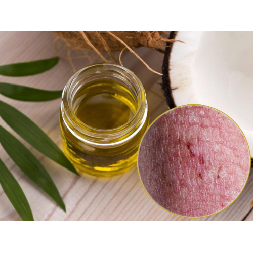 Những Món Ngon Với Dầu Dừa Mà Bạn Chưa Biết